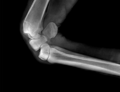 SIUI VET X-ray Röntgenaufnahme: Gelenk gebeugt