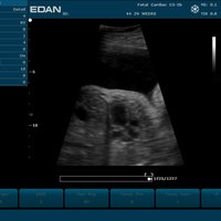 thumb: U2 Vet Prime Edition