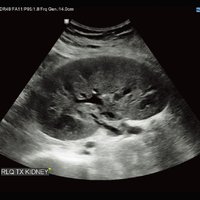 thumb: RS80A Prestige