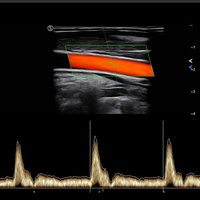 thumb: Farbdoppler mit dem Apogee 6500