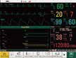 thumb: iM50 - Multi-Parameter-Patientenmonitor
