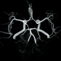 thumb: Easy Brain Protocol TOF 132 Sek. 