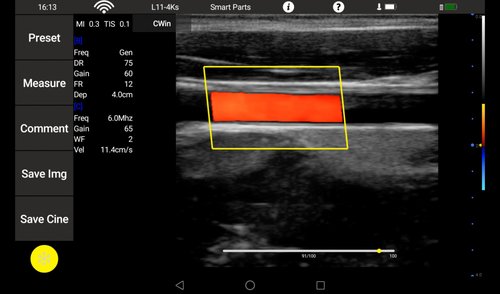 Farbdoppler des Youkey QSONO D8