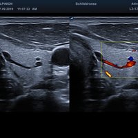 thumb: E-CUBE 8 Diamond