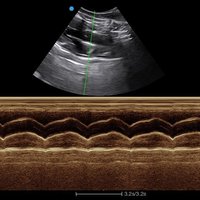 thumb: Ultraschalluntersuchung mit dem Apogee 1000V Lite