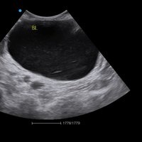 thumb: Ultraschalluntersuchung mit dem Apogee 5300V Neo