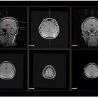 thumb: EasyTech NeuroLine