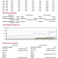 thumb: Cardiomatics Report Beispiel 10