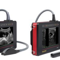 thumb: iScan II mit linearem Rektalkopf (iS II L)