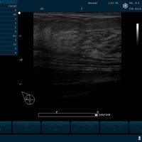 thumb: U2 Prime Edition