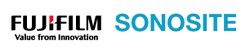 SonoSite