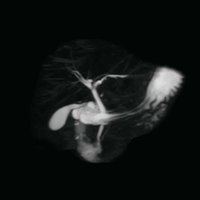 thumb: AIRIS Vento O5 - 0,3T