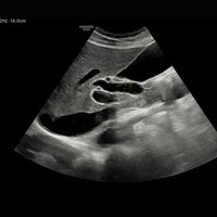 thumb: RS85 Prestige