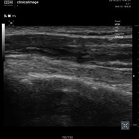 thumb: Convex 300C S/W