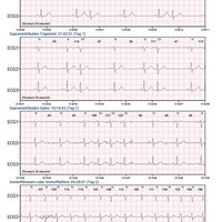 thumb: Cardiomatics Report Beispiel 7