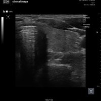 thumb: Convex 300C S/W