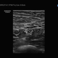 thumb: RS80A Prestige