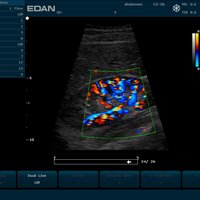 thumb: U2 Vet Prime Edition