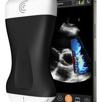 thumb: Clarius PAL HD3 Kardiologie