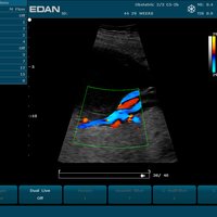 thumb: U2 Vet Prime Edition