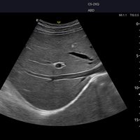 thumb: Abdominalscan mit dem Acclarix AX8 mit eSRI