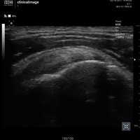 thumb: Convex 300C S/W