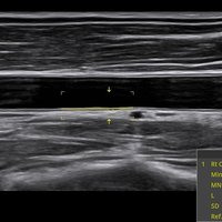thumb: Bildgebung mit dem Apogee 6500