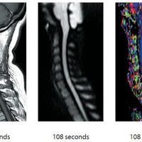 thumb: Easy Spine Protocol