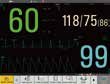 thumb: iM50 - Multi-Parameter-Patientenmonitor