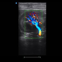 thumb: Ultraschalluntersuchung mit dem Apogee 1000V Neo