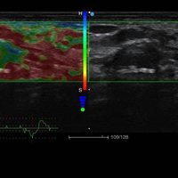 thumb: Diagnostik mit dem Apogee 5300