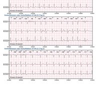 thumb: Cardiomatics Report Beispiel 11