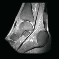 thumb: AIRIS Vento O5 - 0,3T