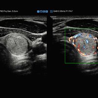 thumb: RS80A Prestige