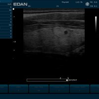 thumb: U2 Vet Prime Edition