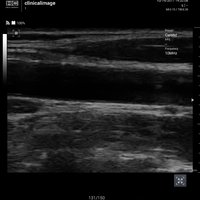 thumb: Convex 300C S/W