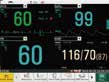 thumb: iM50 - Multi-Parameter-Patientenmonitor