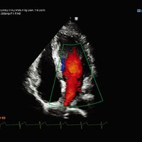 thumb: RS80A Prestige