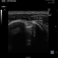 thumb: Convex 300C S/W