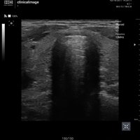 thumb: Convex 300C S/W