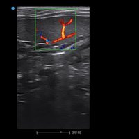 thumb: Farbdoppler mit dem Apogee 2100V