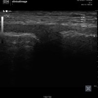 thumb: Convex 300C S/W