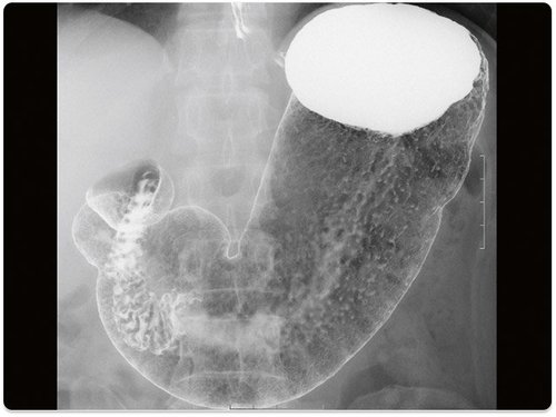 Aufnahme mit Xantara