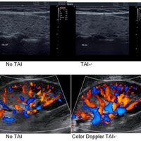 thumb: Tissue Adaptive Imaging (TAI)